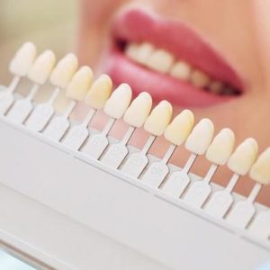 Smile Up Set Basic